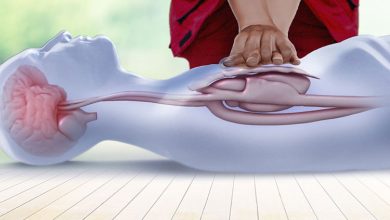 آنچه باید درباره احیای قلبی ریوی بدانیم