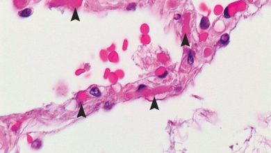 توسعه رباتهای هیبریدی بیولوژیکی برای درمان سرطان