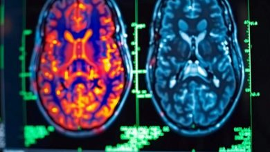 دیابت و تغییرات مغزی: تضعیف حافظه و کاهش لذت از پاداش