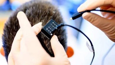 تحولی در فناوری گفتار مصنوعی: بازگشت صدای بیماران فلج با هوش مصنوعی