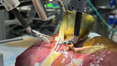 نخستین تجربه واقعی ربات جراح بدون کمک انسان
