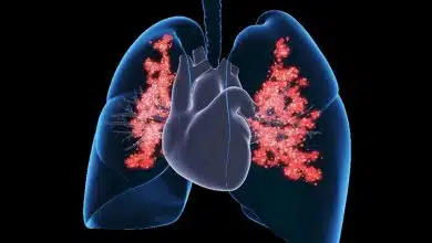 ۵ تأثیر مخرب تغییرات آبوهوایی بر سلامت ریهها + راههای پیشگیری