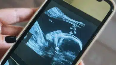 اضطراب میتواند ریشه در دوران جنینی داشته باشد