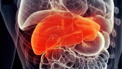 ترکیب دو داروی شناخته‌شده، رویکردی نو برای مقابله با بیماری کبد چرب