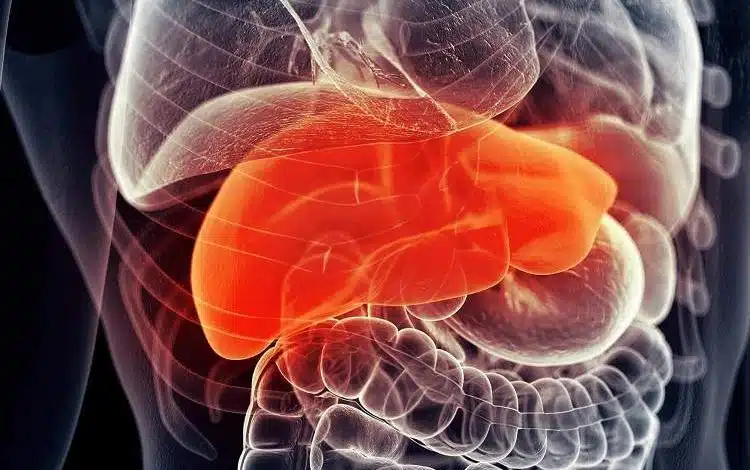 ترکیب دو داروی شناختهشده، رویکردی نو برای مقابله با بیماری کبد چرب
