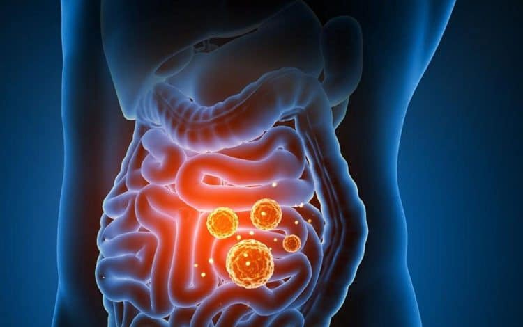 داروهای رایج مانند قرص سرماخوردگی و دیازپام میتوانند تا سالها بر سلامت روده اثر بگذارند