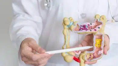 هفت نشانه اولیه سرطان روده بزرگ