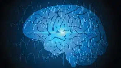 هوش مصنوعی و درمان صرع: شناسایی ضایعات پنهان مغز در کودکان