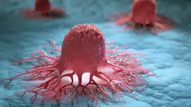 کشف امیدوارکننده دانشمندان اسپانیایی؛ پروتئینی که باعث «خودتخریبی سلول‌های سرطانی» ‏می‌‌شود