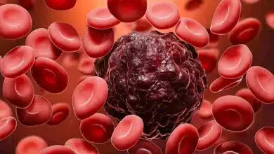 روش جدید نوردرمانی در نیم ساعت، ۹۰ درصد از سلولهای سرطانی را از بین میبرد