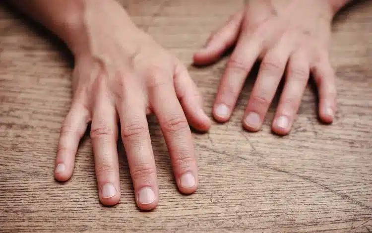 سیانوز دست؛ علت آبی شدن دست و انگشتان + راه‌های درمان