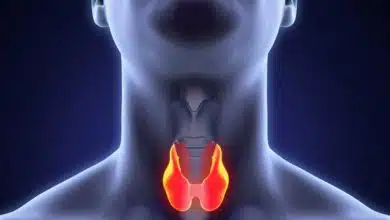 درمان سرطان تیروئید: از تشخیص زودهنگام تا رویکردهای کمتهاجمی نوین