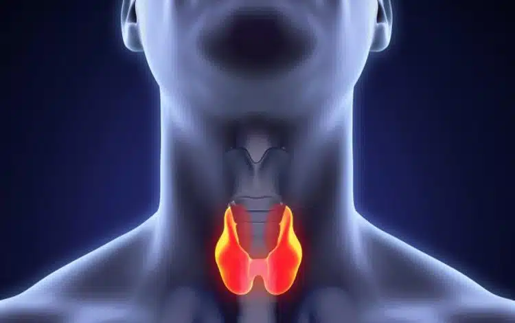 درمان سرطان تیروئید: از تشخیص زودهنگام تا رویکردهای کمتهاجمی نوین