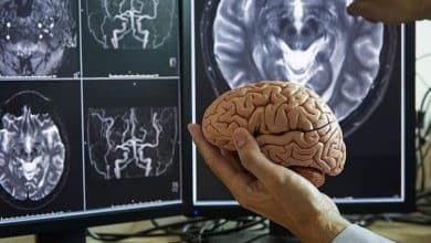 مغز انسان در چهار مقطع کلیدی عمر، بازسازماندهی میشود