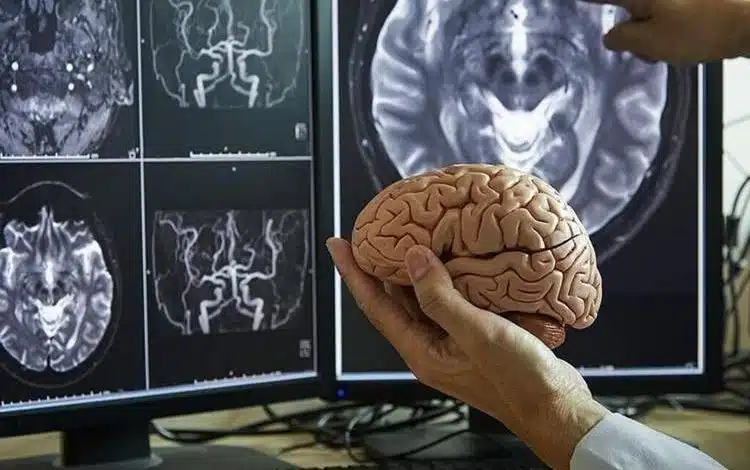 مغز انسان در چهار مقطع کلیدی عمر، بازسازمان‌دهی می‌شود