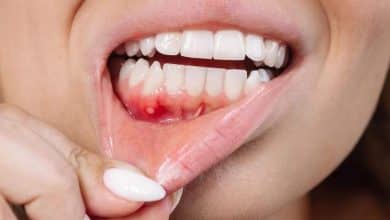 وقتی پوسیدگی دندان به مغز حمله میکند
