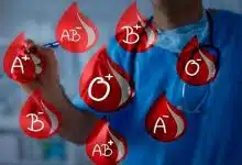 گروه خونی بر احتمال سکته مغزی زودهنگام تاثیر میگذارد