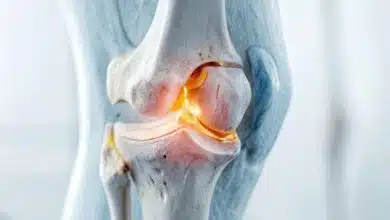 تغییرات خاموش در مغز استخوان ممکن است علامت اولیه سرطان خون باشد