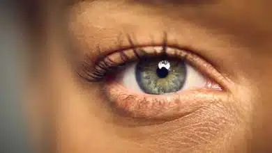پرش پلک چیست و چه زمانی میتواند نشانه یک مشکل جدی باشد؟