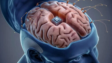 تراشه‌ای که با کمک هوش مصنوعی می‌تواند حافظه آسیب‌دیدگان مغزی را تقویت کند